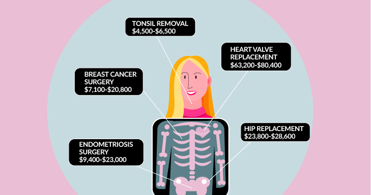 How Much Is Back Surgery With Insurance? rb_thumb